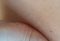 Why are Women More Prone to Thyroid Problems?