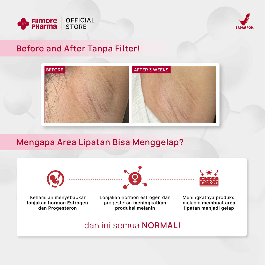 Filmore Inner Thigh Brightening Cream