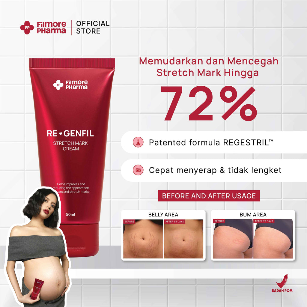 Filmore Regenfil Stretch Mark Cream with REGESTRIL™