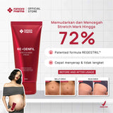 Filmore Regenfil Stretch Mark Cream with REGESTRIL™