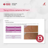 Filmore Regenfil Stretch Mark Cream with REGESTRIL™