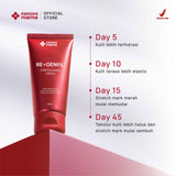 Filmore Regenfil Stretch Mark Cream with REGESTRIL™